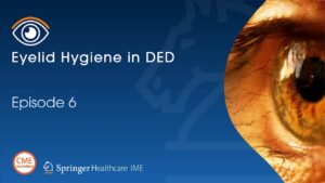 Podcast Episode 6 - Eyelid Hygiene in DED